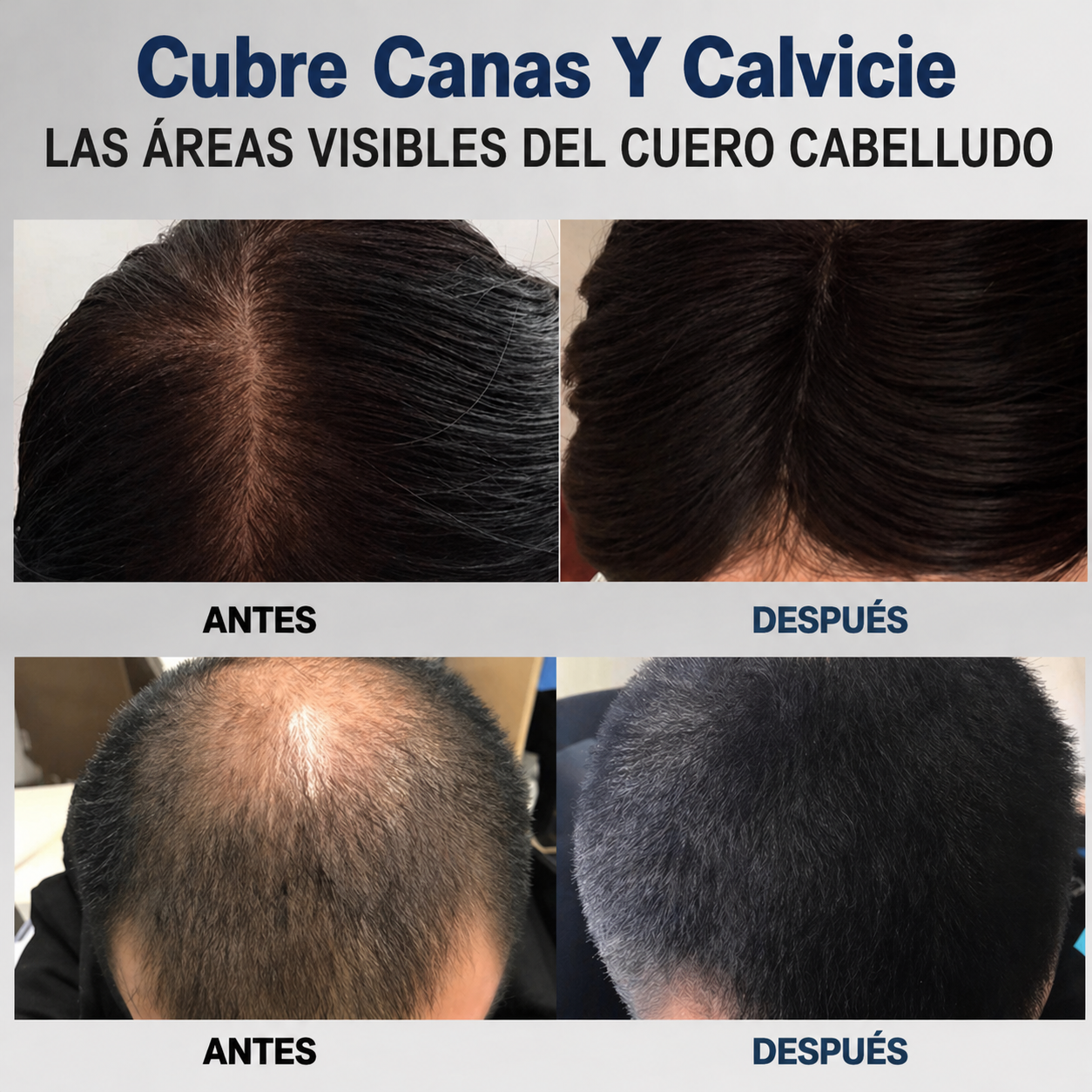 Aliver Tapa Canas Y Calvicie (COLOR NEGRO)